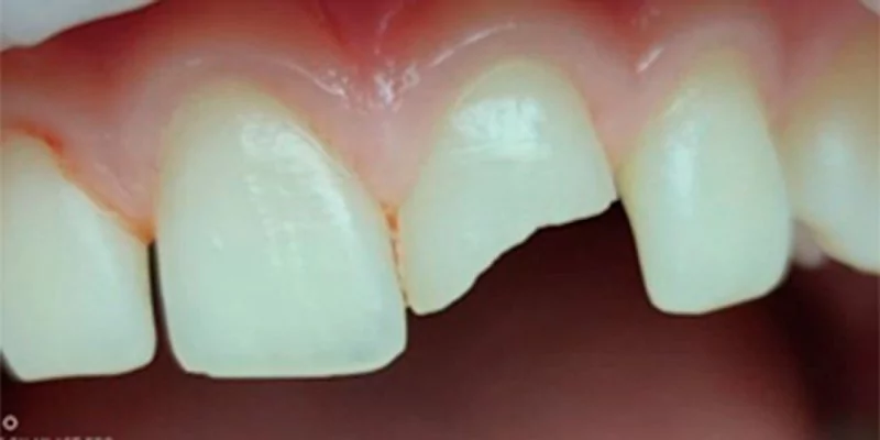 До - Комплексная гигиена